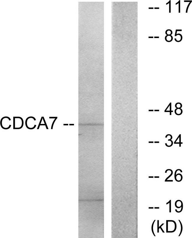 CDCA7 Antibody - Western blot analysis of extracts from K562 cells, using CDCA7 antibody.