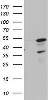 CDCA7L Antibody - HEK293T cells were transfected with the pCMV6-ENTRY control (Left lane) or pCMV6-ENTRY CDCA7L (Right lane) cDNA for 48 hrs and lysed. Equivalent amounts of cell lysates (5 ug per lane) were separated by SDS-PAGE and immunoblotted with anti-CDCA7L.