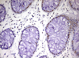 CDCA7L Antibody - IHC of paraffin-embedded Human colon tissue using anti-CDCA7L mouse monoclonal antibody. (Heat-induced epitope retrieval by 10mM citric buffer, pH6.0, 120°C for 3min).