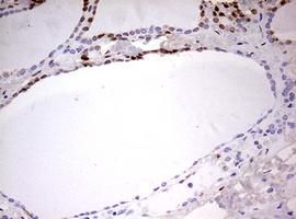CDCA7L Antibody - IHC of paraffin-embedded Human thyroid tissue using anti-CDCA7L mouse monoclonal antibody. (Heat-induced epitope retrieval by 10mM citric buffer, pH6.0, 120°C for 3min).