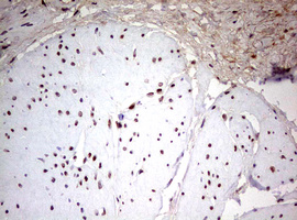 CDCA7L Antibody - IHC of paraffin-embedded Human bladder tissue using anti-CDCA7L mouse monoclonal antibody. (Heat-induced epitope retrieval by 10mM citric buffer, pH6.0, 120°C for 3min).