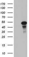 CDCA7L Antibody - HEK293T cells were transfected with the pCMV6-ENTRY control (Left lane) or pCMV6-ENTRY CDCA7L (Right lane) cDNA for 48 hrs and lysed. Equivalent amounts of cell lysates (5 ug per lane) were separated by SDS-PAGE and immunoblotted with anti-CDCA7L.