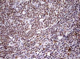 CDCA7L Antibody - IHC of paraffin-embedded Human tonsil using anti-CDCA7L mouse monoclonal antibody. (Heat-induced epitope retrieval by 10mM citric buffer, pH6.0, 120°C for 3min).
