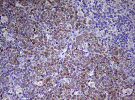 CDCA7L Antibody - IHC of paraffin-embedded Human lymph node tissue using anti-CDCA7L mouse monoclonal antibody. (Heat-induced epitope retrieval by 10mM citric buffer, pH6.0, 120°C for 3min).