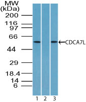 CDCA7L Antibody - Western blot of CDCA7L/RAM2 in HCT-116 cell lysate in the 1) absence and 2) presence of immunizing peptide and 3) NIH 3T3 cell lysate using Peptide-affinity Purified Polyclonal Antibody to CDCA7L/RAM2 at 4 ug/ml and 2 ug/ml, respectively. Goat anti-rabbit Ig HRP secondary antibody, and PicoTect ECL substrate solution, were used for this test.