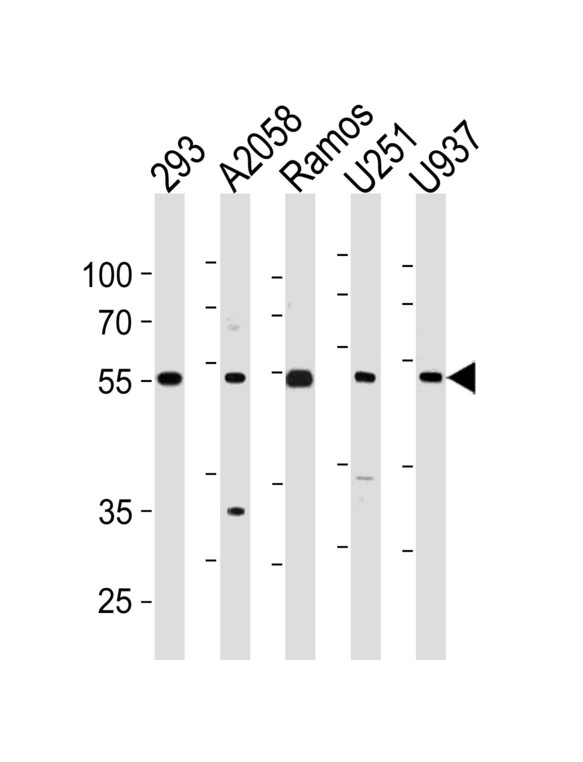 CDCA7L Antibody - CDCA7L Antibody western blot of 293,A2058,Ramos,U251,U937 cell line lysates (35 ug/lane). The CDCA7L antibody detected the CDCA7L protein (arrow).