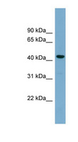 CDCA7L Antibody - CDCA7L antibody Western blot of COLO205 cell lysate. This image was taken for the unconjugated form of this product. Other forms have not been tested.