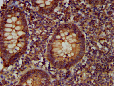 CDCA7L Antibody - Immunohistochemistry image at a dilution of 1:400 and staining in paraffin-embedded human appendix tissue performed on a Leica BondTM system. After dewaxing and hydration, antigen retrieval was mediated by high pressure in a citrate buffer (pH 6.0) . Section was blocked with 10% normal goat serum 30min at RT. Then primary antibody (1% BSA) was incubated at 4 °C overnight. The primary is detected by a biotinylated secondary antibody and visualized using an HRP conjugated SP system.