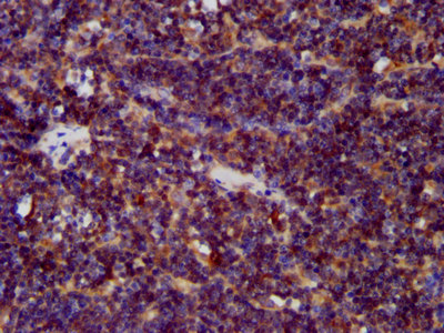 CDCA7L Antibody - Immunohistochemistry image at a dilution of 1:400 and staining in paraffin-embedded human lymph node tissue performed on a Leica BondTM system. After dewaxing and hydration, antigen retrieval was mediated by high pressure in a citrate buffer (pH 6.0) . Section was blocked with 10% normal goat serum 30min at RT. Then primary antibody (1% BSA) was incubated at 4 °C overnight. The primary is detected by a biotinylated secondary antibody and visualized using an HRP conjugated SP system.