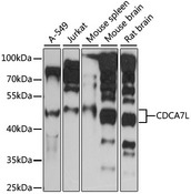 CDCA7L Antibody - Western blot analysis of extracts of various cell lines, using CDCA7L antibody at 1:1000 dilution. The secondary antibody used was an HRP Goat Anti-Rabbit IgG (H+L) at 1:10000 dilution. Lysates were loaded 25ug per lane and 3% nonfat dry milk in TBST was used for blocking. An ECL Kit was used for detection and the exposure time was 90s.