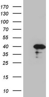 CDCA8 / Borealin Antibody - HEK293T cells were transfected with the pCMV6-ENTRY control. (Left lane) or pCMV6-ENTRY CDCA8. (Right lane) cDNA for 48 hrs and lysed. Equivalent amounts of cell lysates. (5 ug per lane) were separated by SDS-PAGE and immunoblotted with anti-CDCA8. (1:2000)