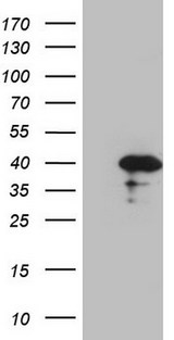 CDCA8 / Borealin Antibody - HEK293T cells were transfected with the pCMV6-ENTRY control. (Left lane) or pCMV6-ENTRY CDCA8. (Right lane) cDNA for 48 hrs and lysed