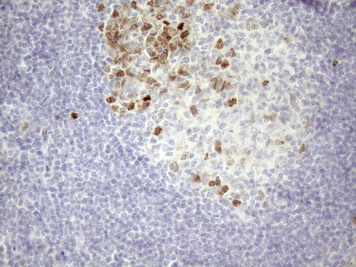CDCA8 / Borealin Antibody - Immunohistochemical staining of paraffin-embedded Human tonsil within the normal limits using anti-CDCA8 mouse monoclonal antibody. (Heat-induced epitope retrieval by 1mM EDTA in 10mM Tris buffer. (pH8.5) at 120 oC for 3 min. (1:150)