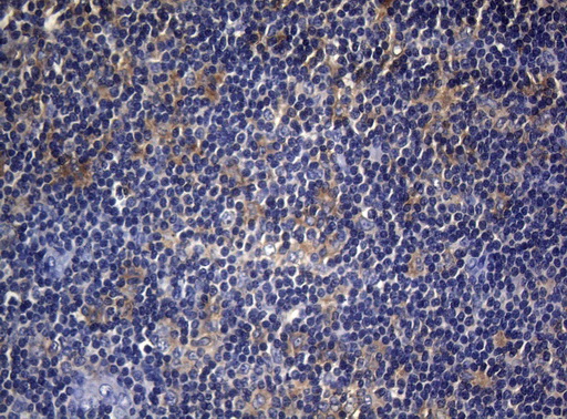CDCA8 / Borealin Antibody - Immunohistochemical staining of paraffin-embedded Human tonsil within the normal limits using anti-CDCA8 mouse monoclonal antibody. (Heat-induced epitope retrieval by 1mM EDTA in 10mM Tris buffer. (pH8.5) at 120°C for 3 min. (1:150)