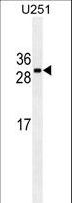 CDCA8 / Borealin Antibody - CDCA8 Antibody western blot of U251 cell line lysates (35 ug/lane). The CDCA8 antibody detected the CDCA8 protein (arrow).