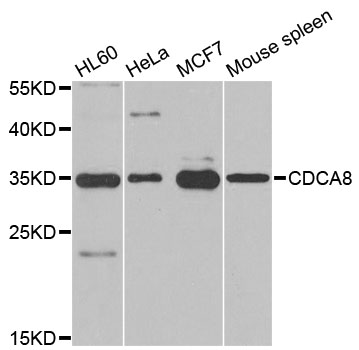 CDCA8 / Borealin Antibody - Western blot analysis of extracts of various cell lines, using CDCA8 antibody at 1:500 dilution. The secondary antibody used was an HRP Goat Anti-Rabbit IgG (H+L) at 1:10000 dilution. Lysates were loaded 25ug per lane and 3% nonfat dry milk in TBST was used for blocking. An ECL Kit was used for detection and the exposure time was 60s.