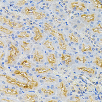 CDCA8 / Borealin Antibody - Immunohistochemistry of paraffin-embedded rat kidney using CDCA8 antibody(40x lens).