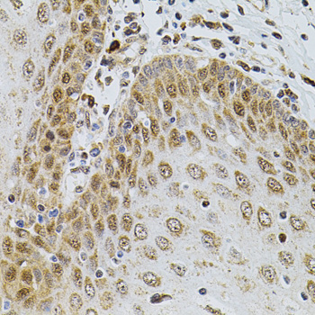 CDCA8 / Borealin Antibody - Immunohistochemistry of paraffin-embedded human esophagus using CDCA8 antibody(40x lens).