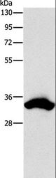 CDCA8 / Borealin Antibody - Western blot analysis of 293T cell, using CDCA8 Polyclonal Antibody at dilution of 1:900.