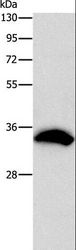 CDCA8 / Borealin Antibody - Western blot analysis of 293T cell, using CDCA8 Polyclonal Antibody at dilution of 1:800.