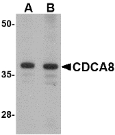 CDCA8 / Borealin Antibody - Western blot of CDCA8 in Rat kidney lysate with CDCA8 antibody at (A) 1 and (B) 2 ug/ml.