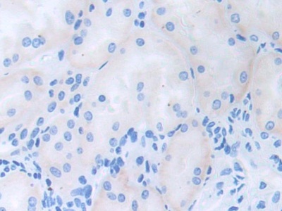 CDCP1 Antibody - Western Blot; Sample: Recombinant CDCP1, Human