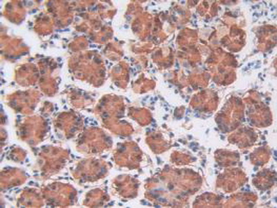 CDCP1 Antibody - Western Blot; Sample: Human A549 Cells.