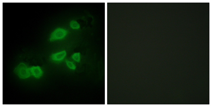 CDCP1 Antibody - Immunofluorescence analysis of HepG2 cells, using CDCP1 Antibody. The picture on the right is blocked with the synthesized peptide.