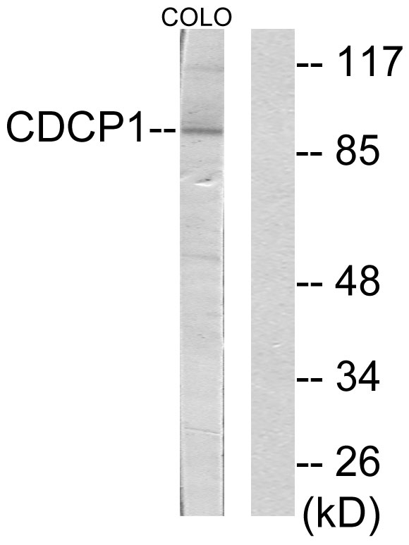 CDCP1 Antibody - Western blot analysis of lysates from COLO205 cells, using CDCP1 Antibody. The lane on the right is blocked with the synthesized peptide.