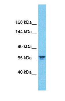 CDCP1 Antibody - Western blot of CDCP1 Antibody with human MCF7 Whole Cell lysate.  This image was taken for the unconjugated form of this product. Other forms have not been tested.