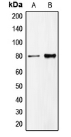 CDCP1 Antibody - Western blot analysis of CD318 expression in HeLa (A); DU145 (B) whole cell lysates.