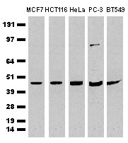 CDCP1 Antibody - Western Blot analysis of extracts (35&#181;g) from 5 different cell lines by using anti-CDCP1 monoclonal antibody (Clone 3B5).