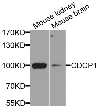 CDCP1 Antibody - Western blot analysis of extract of various cells.