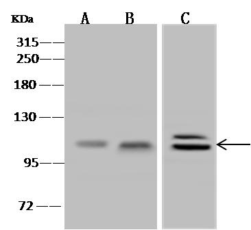 CDCP1 Antibody - Anti-CDCP1 rabbit polyclonal antibody at 1:500 dilution. Lane A: HepG2 Whole Cell Lysate. Lane B: HeLa Whole Cell Lysate. Lane C: Jurkat Whole Cell Lysate. Lysates/proteins at 30 ug per lane. Secondary: Goat Anti-Rabbit IgG (H+L)/HRP at 1/10000 dilution. Developed using the ECL technique. Performed under reducing conditions. Predicted band size: 93 kDa.