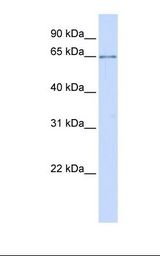 CDG1C / ALG6 Antibody - Hela cell lysate. Antibody concentration: 1.0 ug/ml. Gel concentration: 12%.  This image was taken for the unconjugated form of this product. Other forms have not been tested.