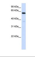 CDG1C / ALG6 Antibody - Fetal heart lysate. Antibody concentration: 1.0 ug/ml. Gel concentration: 12%.  This image was taken for the unconjugated form of this product. Other forms have not been tested.