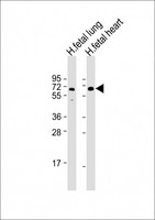 CDG1C / ALG6 Antibody - All lanes: Anti-ALG6 Antibody (Center) at 1:2000 dilution Lane 1: human fetal lung lysate Lane 2: human fetal heart lysate Lysates/proteins at 20 µg per lane. Secondary Goat Anti-Rabbit IgG, (H+L), Peroxidase conjugated at 1/10000 dilution. Predicted band size: 58 kDa Blocking/Dilution buffer: 5% NFDM/TBST.