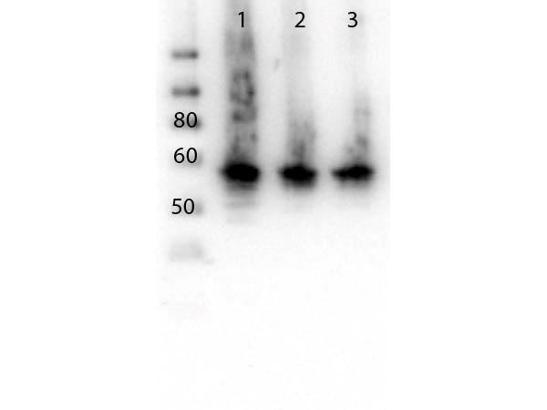 CDG1C / ALG6 Antibody - Western Blot of rabbit anti-ALG6 antibody. Lane 1: HeLa Whole Cell lysate. Lane 2: MOLT4 Whole Cell lysate. Lane 3: K-562 Whole Cell lysate. Load: 10 µg per lane. Primary antibody: ALG6 antibody at 1:500 for overnight at 4°C. Secondary antibody: Peroxidase rabbit secondary antibody at 1:40,000 for 30 min at RT. Block: TBS-Casein overnight at 4°C. Predicted/Observed size: 58 kDa ALG-6.