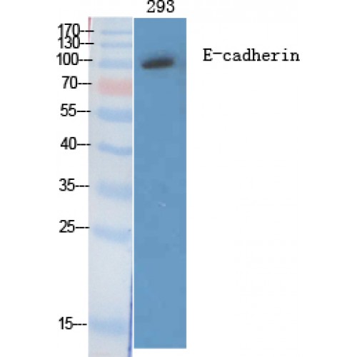 CDH1 / E Cadherin Antibody - Western blot of E-cadherin antibody