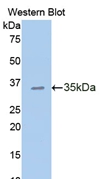 CDH1 / E Cadherin Antibody - Western Blot; Sample: Recombinant protein.