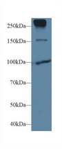 CDH1 / E Cadherin Antibody - Western Blot; Sample: Human MCF7 cell lysate; Primary Ab: 1µg/ml Rabbit Anti-Human CDHE Antibody Second Ab: 0.2µg/mL HRP-Linked Caprine Anti-Rabbit IgG Polyclonal Antibody