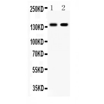 CDH1 / E Cadherin Antibody - E Cadherin antibody Western blot. All lanes: Anti E Cadherin at 0.5 ug/ml. Lane 1: Human Placenta Tissue Lysate at 50 ug. Lane 2: HELA Whole Cell Lysate at 40 ug. Predicted band size: 140 kD. Observed band size: 140 kD.