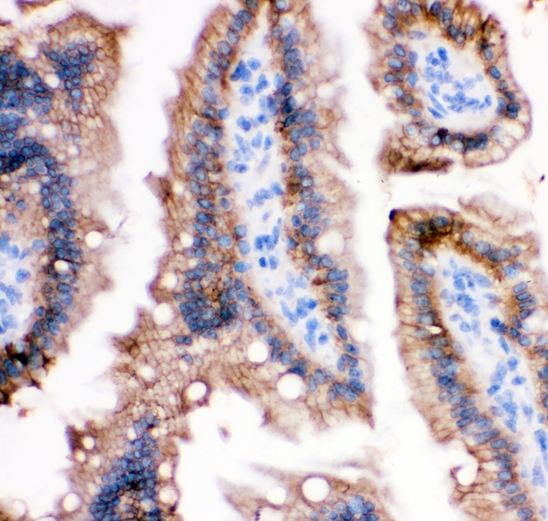 CDH1 / E Cadherin Antibody - IHC analysis of E Cadherin using anti-E Cadherin antibody. E Cadherin was detected in paraffin-embedded section of mouse intestine tissues. Heat mediated antigen retrieval was performed in citrate buffer (pH6, epitope retrieval solution) for 20 mins. The tissue section was blocked with 10% goat serum. The tissue section was then incubated with 1µg/ml rabbit anti-E Cadherin Antibody overnight at 4°C. Biotinylated goat anti-rabbit IgG was used as secondary antibody and incubated for 30 minutes at 37°C. The tissue section was developed using Strepavidin-Biotin-Complex (SABC) with DAB as the chromogen.
