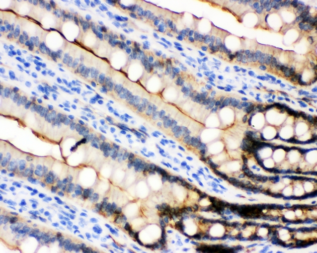 CDH1 / E Cadherin Antibody - IHC analysis of E Cadherin using anti-E Cadherin antibody. E Cadherin was detected in paraffin-embedded section of rat intestine tissues. Heat mediated antigen retrieval was performed in citrate buffer (pH6, epitope retrieval solution) for 20 mins. The tissue section was blocked with 10% goat serum. The tissue section was then incubated with 1µg/ml rabbit anti-E Cadherin Antibody overnight at 4°C. Biotinylated goat anti-rabbit IgG was used as secondary antibody and incubated for 30 minutes at 37°C. The tissue section was developed using Strepavidin-Biotin-Complex (SABC) with DAB as the chromogen.