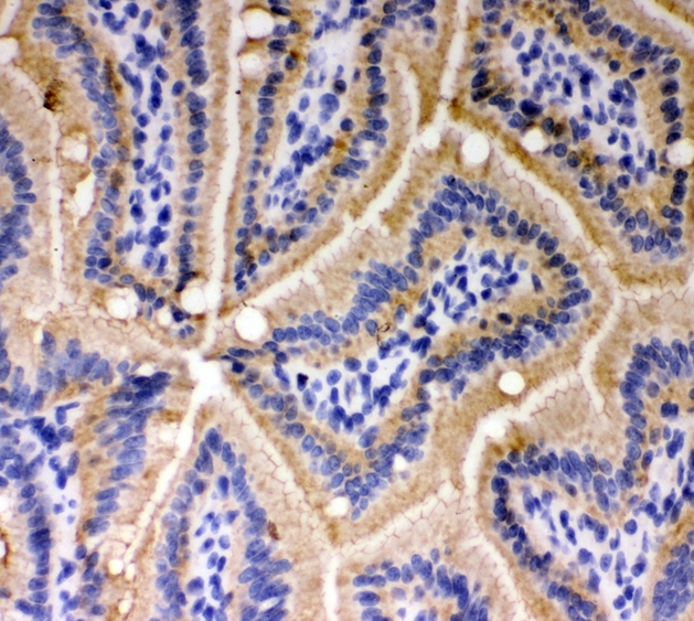 CDH1 / E Cadherin Antibody - IHC analysis of E Cadherin using anti-E Cadherin antibody. E Cadherin was detected in frozen section of mouse intestine tissues. Heat mediated antigen retrieval was performed in citrate buffer (pH6, epitope retrieval solution) for 20 mins. The tissue section was blocked with 10% goat serum. The tissue section was then incubated with 1µg/ml rabbit anti-E Cadherin Antibody overnight at 4°C. Biotinylated goat anti-rabbit IgG was used as secondary antibody and incubated for 30 minutes at 37°C. The tissue section was developed using Strepavidin-Biotin-Complex (SABC) with DAB as the chromogen.