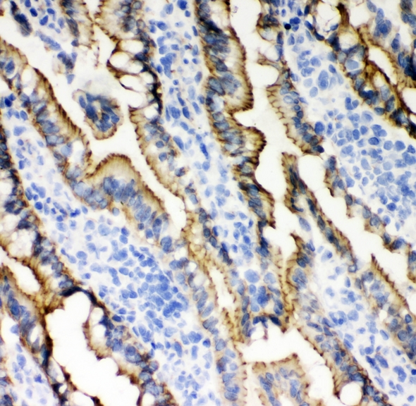 CDH1 / E Cadherin Antibody - IHC analysis of E Cadherin using anti-E Cadherin antibody. E Cadherin was detected in frozen section of rat intestine tissues. Heat mediated antigen retrieval was performed in citrate buffer (pH6, epitope retrieval solution) for 20 mins. The tissue section was blocked with 10% goat serum. The tissue section was then incubated with 1µg/ml rabbit anti-E Cadherin Antibody overnight at 4°C. Biotinylated goat anti-rabbit IgG was used as secondary antibody and incubated for 30 minutes at 37°C. The tissue section was developed using Strepavidin-Biotin-Complex (SABC) with DAB as the chromogen.