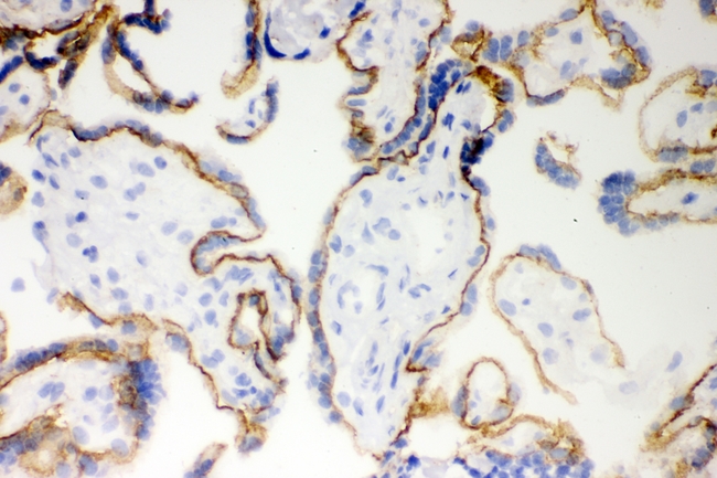 CDH1 / E Cadherin Antibody - IHC analysis of E Cadherin using anti-E Cadherin antibody. E Cadherin was detected in frozen section of human placenta tissues. Heat mediated antigen retrieval was performed in citrate buffer (pH6, epitope retrieval solution) for 20 mins. The tissue section was blocked with 10% goat serum. The tissue section was then incubated with 1µg/ml rabbit anti-E Cadherin Antibody overnight at 4°C. Biotinylated goat anti-rabbit IgG was used as secondary antibody and incubated for 30 minutes at 37°C. The tissue section was developed using Strepavidin-Biotin-Complex (SABC) with DAB as the chromogen.