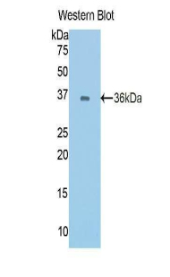 CDH1 / E Cadherin Antibody - Western blot of recombinant CDH1 / E Cadherin.  This image was taken for the unconjugated form of this product. Other forms have not been tested.