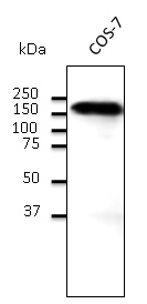 CDH1 / E Cadherin Antibody - Western blot. Endogenous CDH1 detected with CDH1 / E Cadherin antibody at 1:500 dilution. Lysate at 100 ug per lane and rabbit polyclonal to goat IgG (HRP) at 1:10000 dilution.