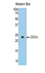 CDH1 / E Cadherin Antibody - Western blot of recombinant CDH1 / E Cadherin.  This image was taken for the unconjugated form of this product. Other forms have not been tested.